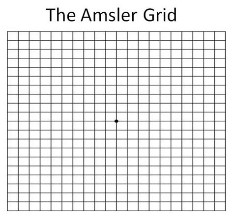 amsler grid eye chart.